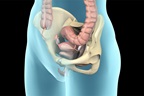 Pelvic Prolapse