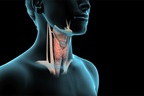 Thyroidectomy