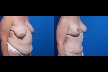 Cosmetic Medicine and Surgery at Mercy