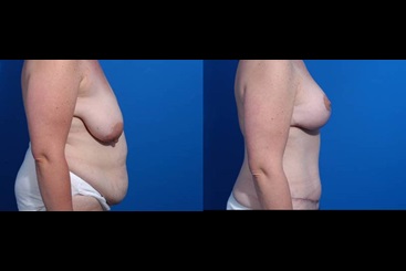 Cosmetic Medicine and Surgery at Mercy