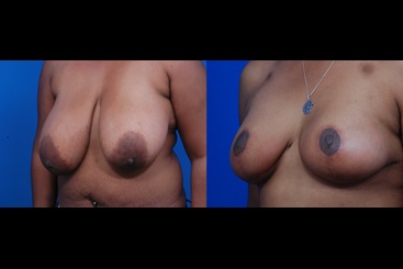 Cosmetic Medicine and Surgery at Mercy